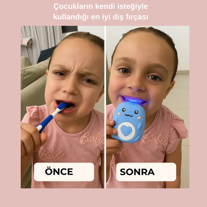 U Şeklinde Akıllı Diş Fırçası